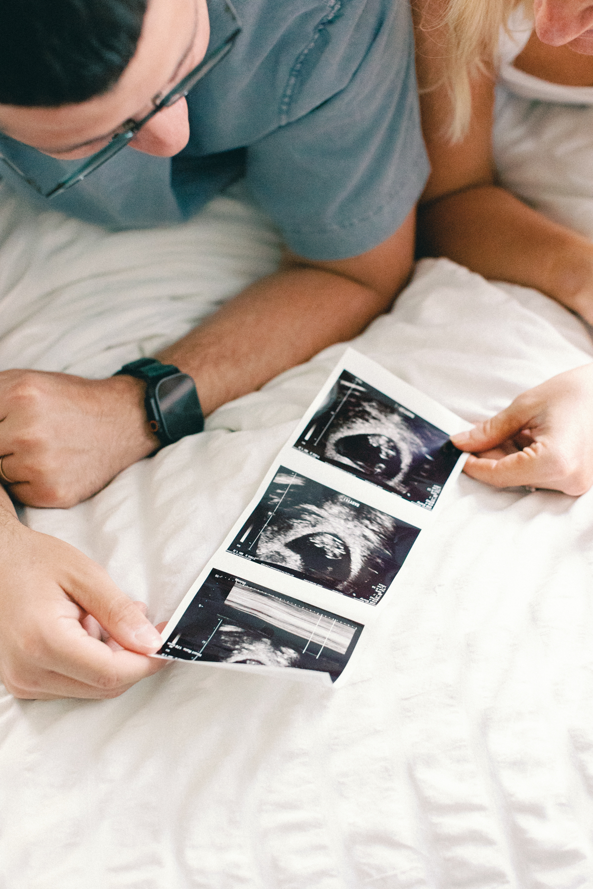 ultrasound picture up close