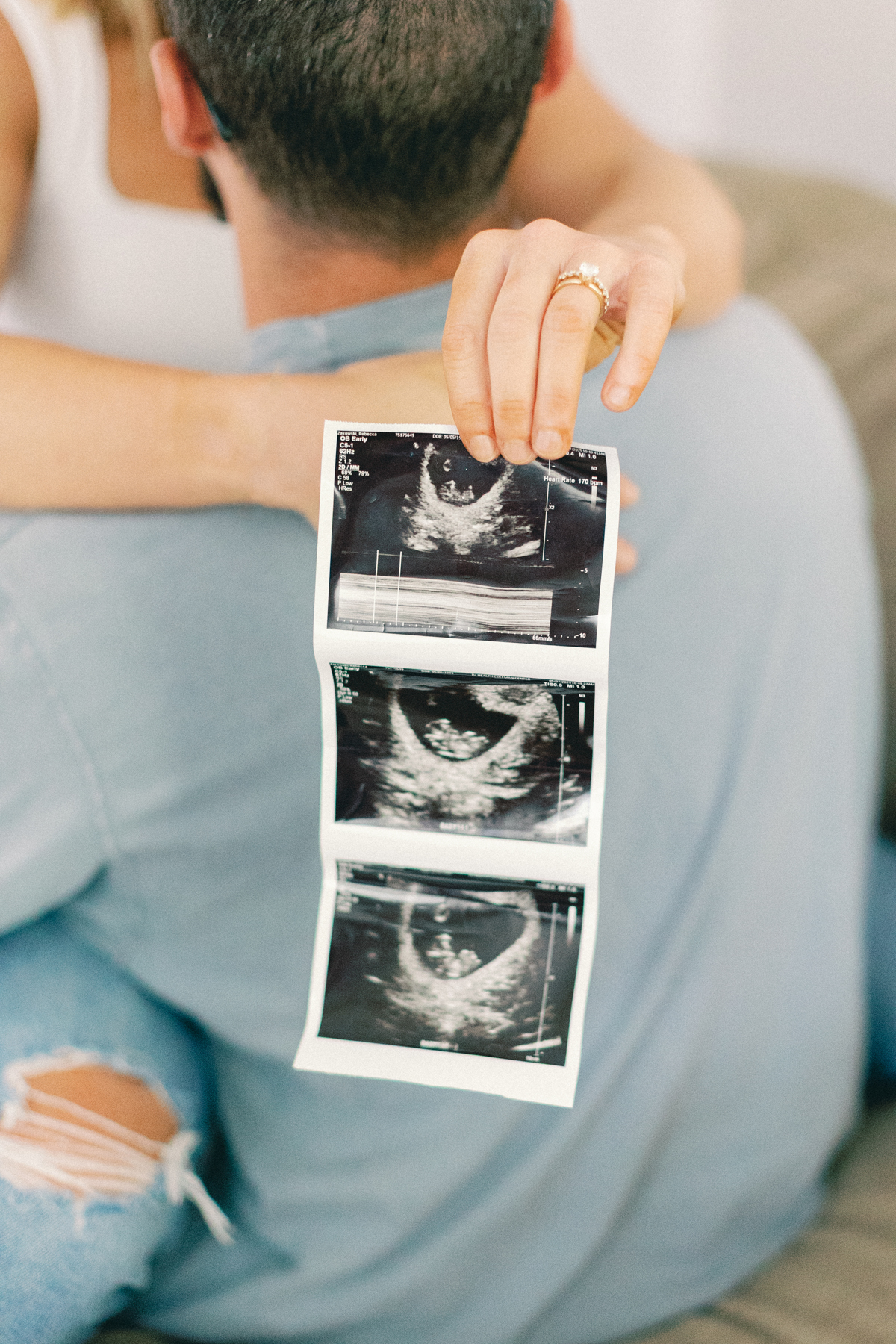 ultrasound picture up close